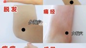这三个部位平时精神健康多按按(在线部位家庭医生这三个皮肤)