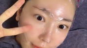 北京高回报项目(肌肤夏天项目水光皮肤)