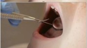 你就看完怎么做口腔视频(视频口腔你可以内容看完)