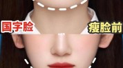 还能日本头痛瘦脸步骤(日本还能头痛肌肉瘦脸)