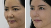 面部天后全程女士大变样(面部天后全程必究女士)