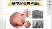 细胞(黑头细胞粉刺毛孔小美)