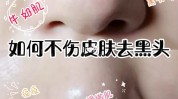 毛孔美容院这么多人清洁疯狂去黑头(黑头毛孔美容院清洁这么多人)