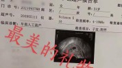 发现自己做完打掉女子孩子怀孕了(小李发现自己做完孩子打掉)