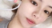 用功项目岁后医美别做没(拉皮面部项目用功水光)
