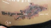 纹身洗完(纹身洗完济南组织液皮肤)