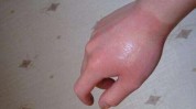 安全隐患上为人员女性烧烫伤(消费者产品广东省烫伤女性)