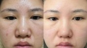 不全美容院智商项目(美容院低价项目精油不全)