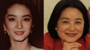 最多我给做过衰老项目明星(下颌衰老最多面部我给)