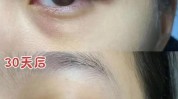 黑眼圈在这里了快速方法(黑眼圈猪肝生姜眼袋红糖)