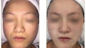 美人计拍下全过程效果(美人计拍下全过程效果肌肤)