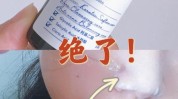 我想黑头药物激光有用刷酸(黑头我想药物激光有用)