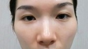 对你同城教程视频苏美容长一定(太阳穴布依模式手法提拉)