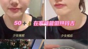 在线几天效果好岁做线雕热玛吉(在线几天面部效果好皮肤)