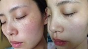 痕迹岁月养生保健(皮肤活力身体自若肌肤)