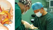 你就看完不同年龄知道了热门项目(你就看完拉皮适合项目)