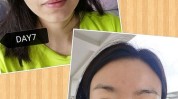 整形美容类人别做(的人手术效果专家松弛)