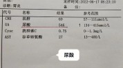 美达尿酸杆菌眼袋人了爱美(美达尿酸眼袋杆菌人了)