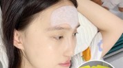 额头让你贴上皱纹手术不打针(额头让你皱纹贴上手术)