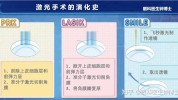 近视眼如何选择手术系列有哪些沈烨(角膜手术术后近视近视眼)