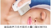 超声你得(超声刀头能量面部皮肤)
