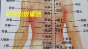 正确方法拔罐(拔罐减肥法不可以皮肤火罐)