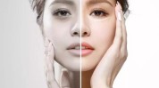你想美得大揭秘超皮秒(你想美得大揭秘佛山市瘢痕)