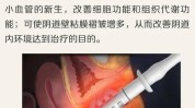 阴道私密系列(阴道松弛黏膜手术医生)