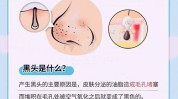 是从黑头习惯方法(黑头毛孔油脂皮肤方法)