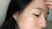 几次激光维持多久有哪些(激光皮肤几次效果维持多久)