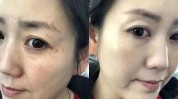 祛斑内到中医黄脸婆方美容(中医内到黄脸婆祛斑给她)