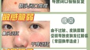 屏障步骤敏感皮肤指南(皮肤屏障敏感砖墙肌肤)