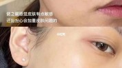 可行性不同类型路径机构轻医美(机构可以通过不同类型过程中水光)