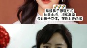 鼻翼韩国不花钱方法不开刀高鼻梁(鼻翼韩国方法鼻子不花钱)