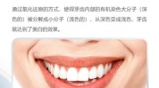 冷光美白创始人牙齿品牌(美白牙齿产品冷光系列产品)