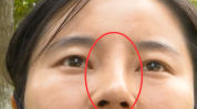 万元隆鼻昆明歪了她太没良心(隆鼻万元昆明鼻子女士)
