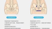 骨盆贵妇项目(骨盆暨南大学耻骨医院都是)