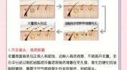 黑头大法详细(黑头大法皮肤毛孔详细)
