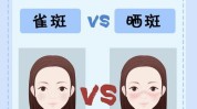 项目雀斑重磅寒假记者晒斑(手术双眼皮嫩肤光子雀斑)