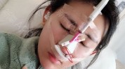 人做建议美容手术(未成年人人做建议美容手术鼻子)