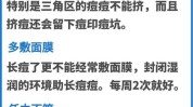 妙招面子(皮肤面膜痘痘粉刺肌肤)