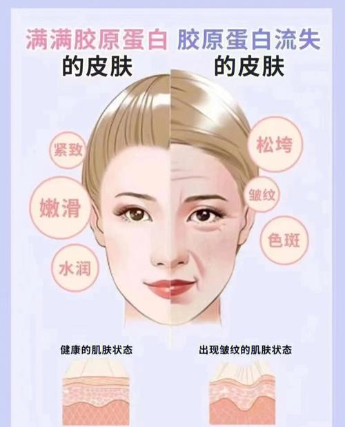 妙招胶原蛋白脸上(胶原蛋白皮肤皮肤病美国皱纹)