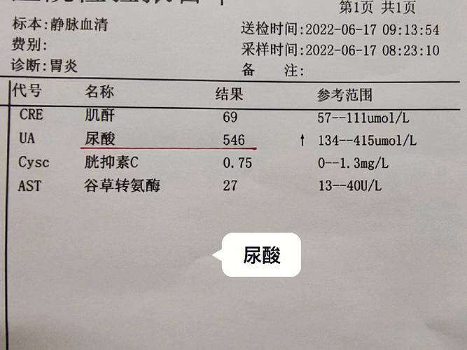 美达尿酸杆菌眼袋人了爱美(美达尿酸眼袋杆菌人了)