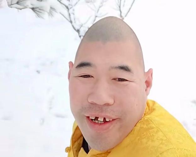 平头生了意想不到顺其自然(平头生了顺其自然意想不到块钱)