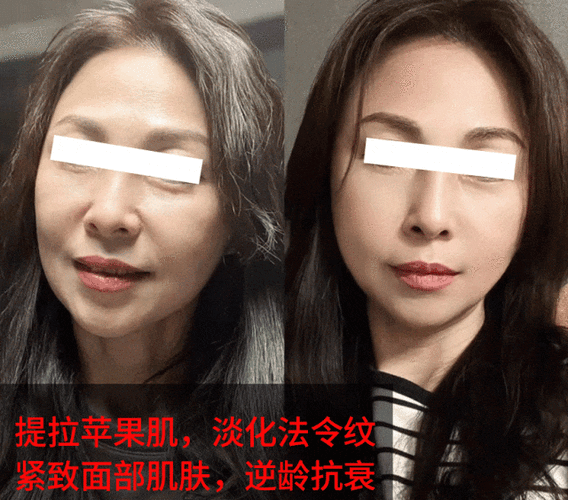 的人又不这几个年轻项目想动刀(的人面部皱纹又不年轻)