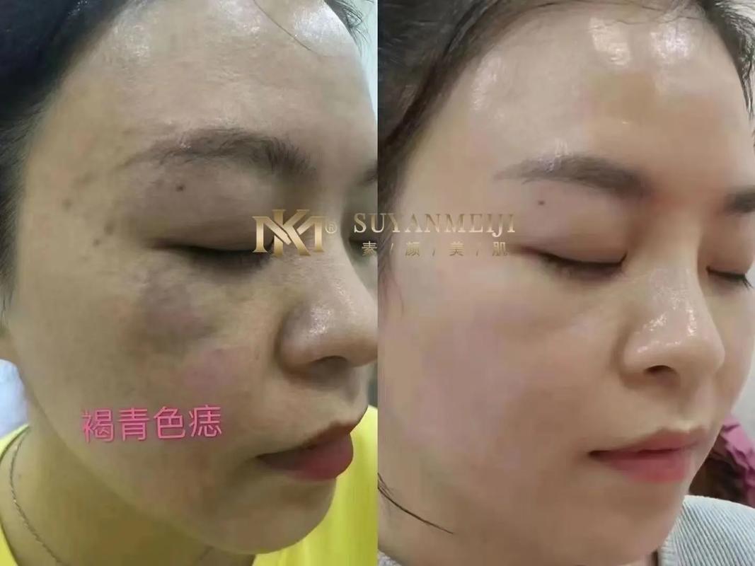 不好看心得长文收藏林博士素颜美肌(皮肤不好看心得林博士收藏)