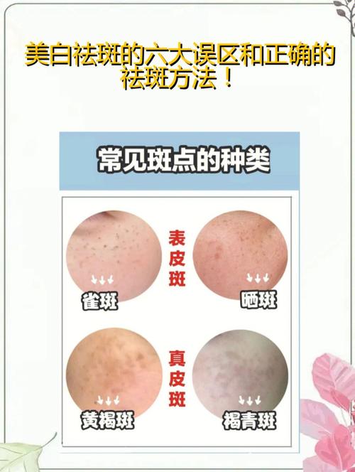 恼人美白祛斑色斑肌肤技巧(肌肤斑点美白恼人色斑)