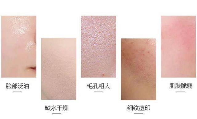 强效又到干燥抑制细纹时间(强效细纹矿泉水皮肤干燥)