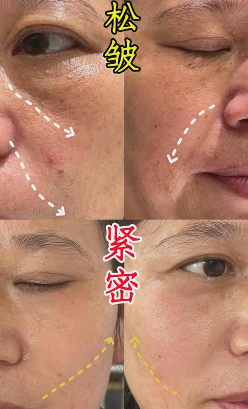万元神器假货爱美别太逆龄(假货效果皮肤机构胶原)