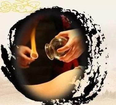 艾灸检察官武汉算不算公益拔罐(公益武汉检察院艾灸检察官)